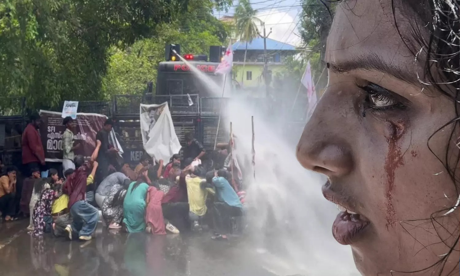 ಕೇರಳ : ಎಸ್‌ಎಫ್‌ಐ ಪ್ರತಿಭಟನೆ ಮೇಲೆ ಲಾಠಿಚಾರ್ಜ್, ವಿದ್ಯಾರ್ಥಿಗಳ ತಲೆಗೆ ಮೊಳೆಗಳ ಲಾಠಿ